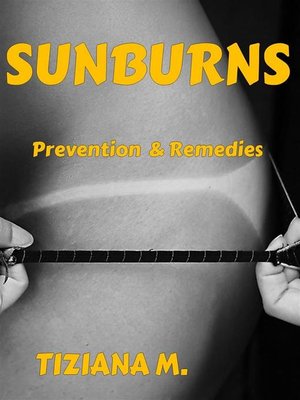 cover image of Sunburns